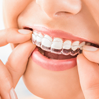 Immagine Terapie Studio Dentistico Uzzielli Treviso 